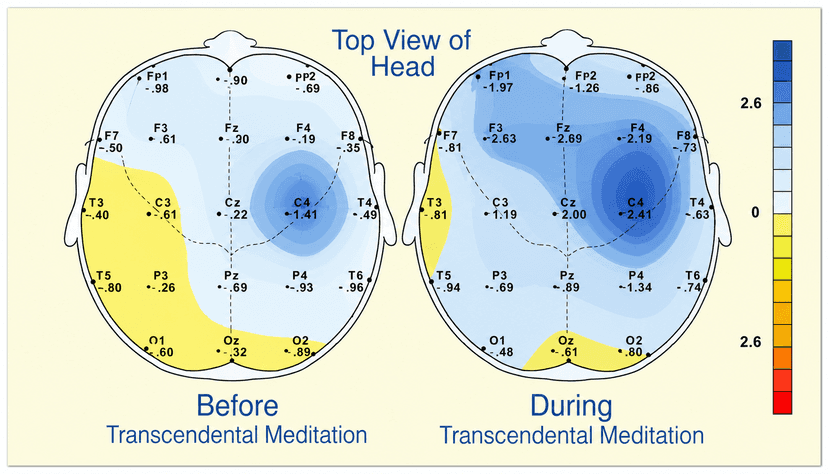 Neuroscience illustration of brain coherence during Transcendental Meditation